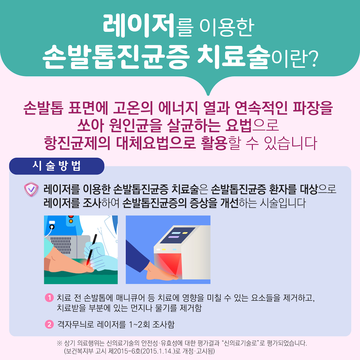 레이저를 이용한 손발톱진균증 치료술 이미지5