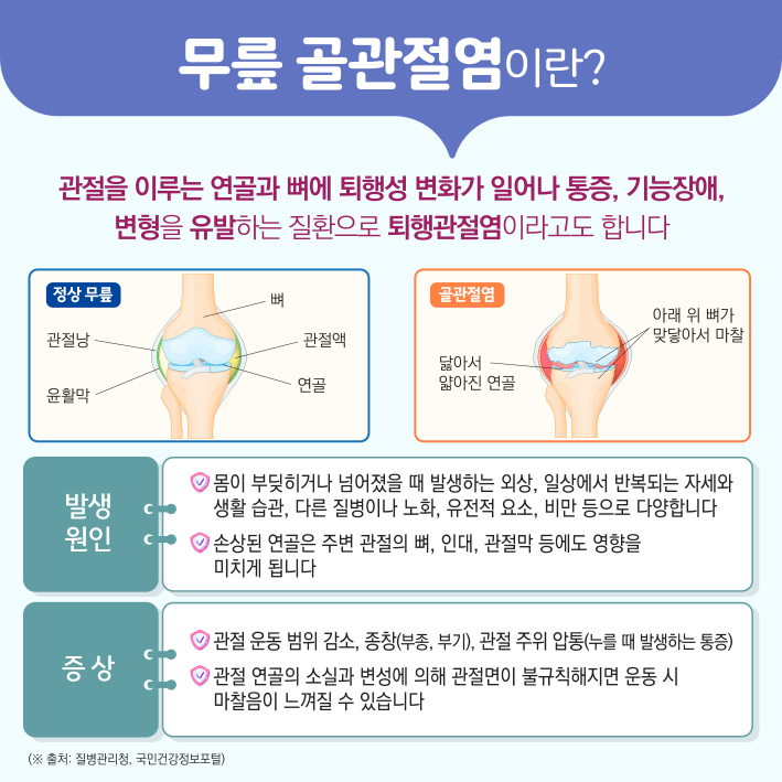 무릎 골관절염에 대한 골수 흡인 농축물 관절강내 주사(BMAC) 이미지2